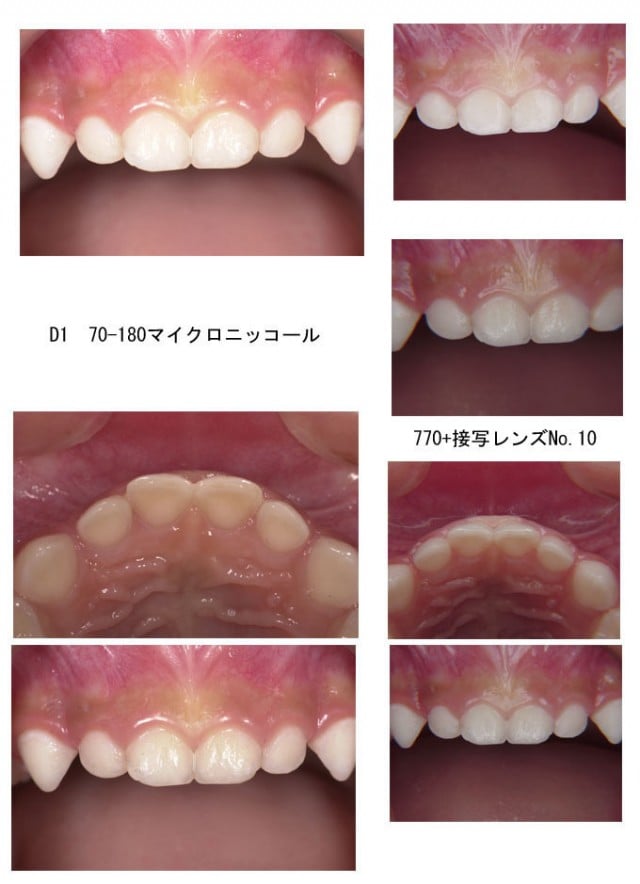 診療用撮影器材（撮影機材）｜なかむら小児歯科医院（公式ホームページ）